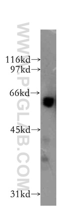 G3BP1 Antibody in Western Blot (WB)