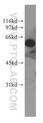 G3BP1 Antibody in Western Blot (WB)