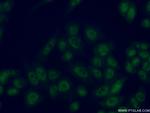 CDK2AP1 Antibody in Immunocytochemistry (ICC/IF)