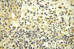 CDK2AP1 Antibody in Immunohistochemistry (Paraffin) (IHC (P))