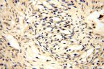 CDK2AP1 Antibody in Immunohistochemistry (Paraffin) (IHC (P))