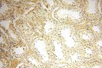 CDK2AP1 Antibody in Immunohistochemistry (Paraffin) (IHC (P))