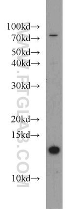 CDK2AP1 Antibody in Western Blot (WB)