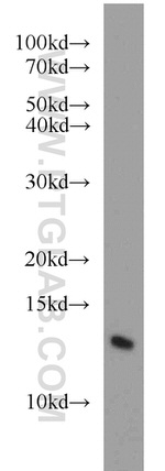 CDK2AP1 Antibody in Western Blot (WB)