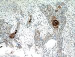 S100A7/Psoriasin Antibody in Immunohistochemistry (Paraffin) (IHC (P))