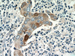 S100A7/Psoriasin Antibody in Immunohistochemistry (Paraffin) (IHC (P))