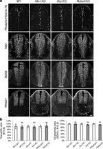 PAX3 Antibody in Immunohistochemistry (IHC)