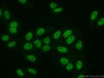 SMARCA5 Antibody in Immunocytochemistry (ICC/IF)