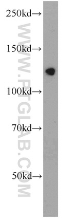 SMARCA5 Antibody in Western Blot (WB)