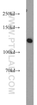 SMARCA5 Antibody in Western Blot (WB)