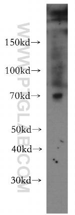 SLC1A4 Antibody in Western Blot (WB)