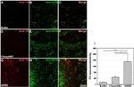 NEFM Antibody in Immunohistochemistry (IHC)