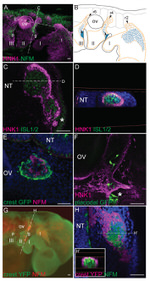 NEFM Antibody in Immunohistochemistry (IHC)