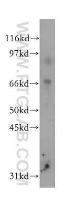 15 Lipoxygenase 2 Antibody in Western Blot (WB)