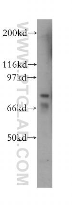 15 Lipoxygenase 2 Antibody in Western Blot (WB)