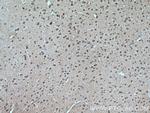 DFNA5 Antibody in Immunohistochemistry (Paraffin) (IHC (P))