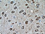 DFNA5 Antibody in Immunohistochemistry (Paraffin) (IHC (P))