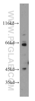 BBS6 Antibody in Western Blot (WB)