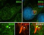 BBS6 Antibody in Immunocytochemistry (ICC/IF)