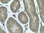 BBS6 Antibody in Immunohistochemistry (Paraffin) (IHC (P))