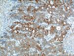 IL-17 Antibody in Immunohistochemistry (Paraffin) (IHC (P))