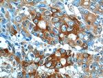 IL-17 Antibody in Immunohistochemistry (Paraffin) (IHC (P))