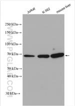 IFNAR1 Antibody in Western Blot (WB)