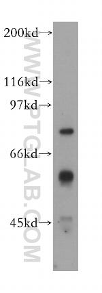 IFNAR1 Antibody in Western Blot (WB)