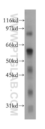 IFNAR1 Antibody in Western Blot (WB)