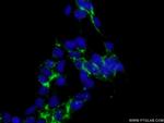 CTNS Antibody in Immunocytochemistry (ICC/IF)