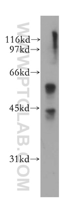 CTNS Antibody in Western Blot (WB)