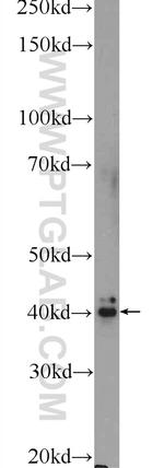 FREM1 Antibody in Western Blot (WB)