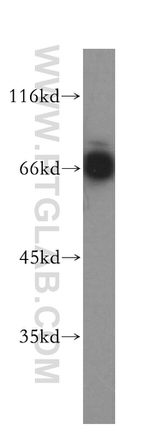 MITF Antibody in Western Blot (WB)