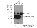 MITF Antibody in Immunoprecipitation (IP)