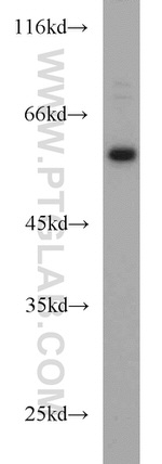 DCT Antibody in Western Blot (WB)