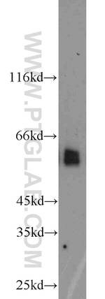 DCT Antibody in Western Blot (WB)