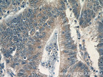 FAS/CD95 Antibody in Immunohistochemistry (Paraffin) (IHC (P))