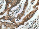 DNAJC10 Antibody in Immunohistochemistry (Paraffin) (IHC (P))