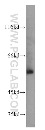 TSEN2 Antibody in Western Blot (WB)