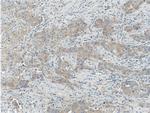 KIF2A Antibody in Immunohistochemistry (Paraffin) (IHC (P))