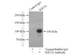 KIF2A Antibody in Immunoprecipitation (IP)