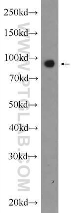 KIF2A Antibody in Western Blot (WB)