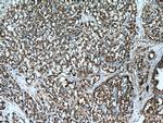 PYCR1 Antibody in Immunohistochemistry (Paraffin) (IHC (P))