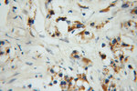 PYCR1 Antibody in Immunohistochemistry (Paraffin) (IHC (P))