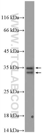 PYCR1 Antibody in Western Blot (WB)