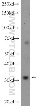 PYCR1 Antibody in Western Blot (WB)