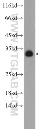 PYCR1 Antibody in Western Blot (WB)