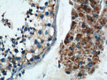 TNF beta Antibody in Immunohistochemistry (Paraffin) (IHC (P))