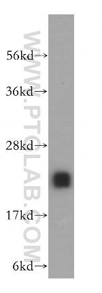 MTHFS Antibody in Western Blot (WB)