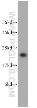 MTHFS Antibody in Western Blot (WB)